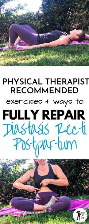 Diastasis Recti Repair, Postpartum Workout Plan, Healing Diastasis Recti, Post Baby Workout, Pregnancy Hacks, Diastasis Recti Exercises, Post Pregnancy Workout, Physical Therapy Exercises, Baby Workout