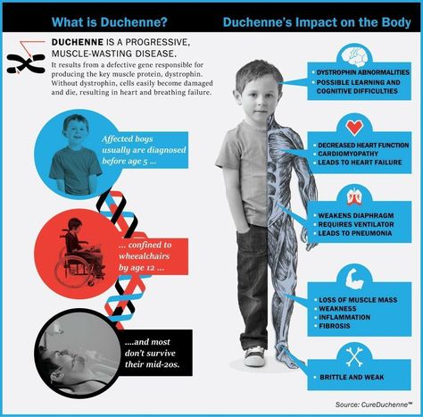 Duchenne Muscular Dystrophy, Gene Editing, Welcome To Holland, To Holland, Muscular Dystrophy, Genetic Diseases, Study Flashcards, Doctors Note, Gene Therapy