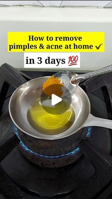 Generated Description with relevant hashtags. How To Pimple Remove, Skin Care For Pimples And Acne, Pimple Remove Tips At Home, How To Remove Pimples At Home, How To Remove Acne, Skincare For Pimples, Skin Care For Pimples, Leg Pimples, How To Treat Pimples