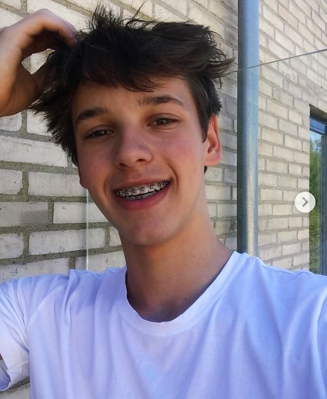 Oscar Rosenstroem, Braces Boy, Boys With Braces, Aron Hernandez, Guys With Braces, Adult Braces, Blonde Kids, Brace Face, Braces Colors