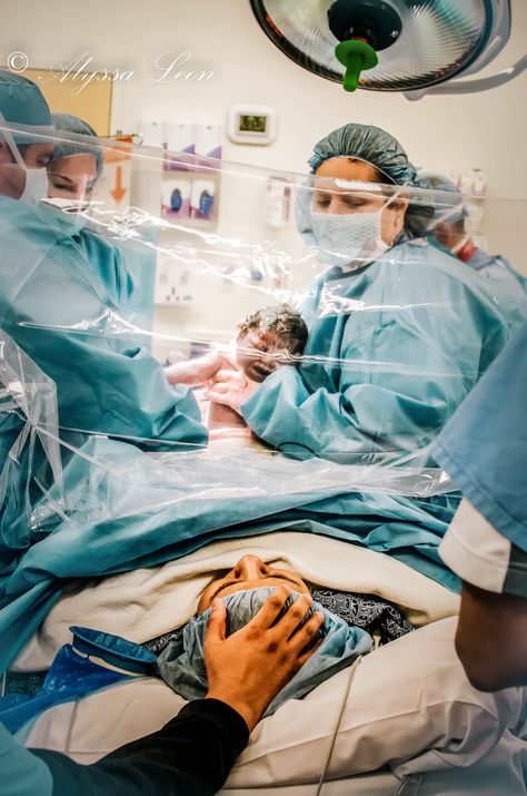 Clear Drapes Let C-Section Moms Witness Their Baby Coming Into The World C Section Pictures, Hospital Pictures, Birth Photos, Birth Photographer, Scary Mommy, Delivery Photos, Baby Sleep Problems, Skin To Skin, Birth Photography