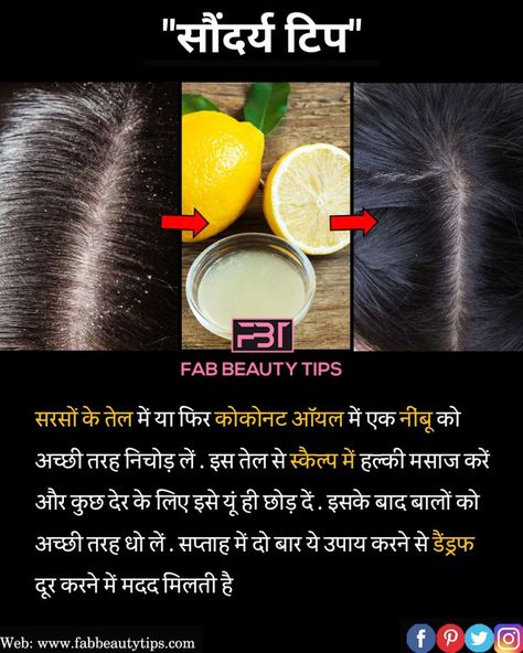 Remedy For Dandruff, Dandruff Solutions, Dandruff Remedy, Hair Care Remedies, Psychology Says, Hair Dandruff, Vitamins For Hair Growth, Ingrown Toe Nail, Diy Remedies