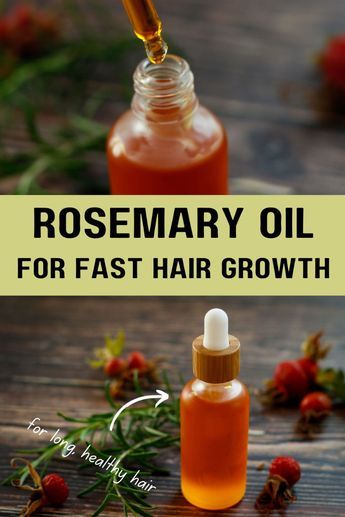 Boost hair growth and prevent hair loss with this DIY Rosemary and Rosehip Oil for hair! It’s easy to make at home, just needs 2 ingredients and only a couple of minutes of your time. Address common hair concerns by adding this homemade hair oil to your natural hair care routine. Nourish your precious mane from the roots to the tips, and simultaneously, you take care of your scalp health (especially if you have a dry scalp). Rosehip promotes hair thickness, faster hair growth, healthy hair, shiny hair. Homemade oil with either fresh or dried rosemary, or rosemary essential oil. Homemade Hair Care DIY recipes Homemade Rosemary Hair Oil, Home Made Hair Serum, Diy Rosemary Oil For Hair, Rosemary Oil For Hair Growth Diy, Rosehip Oil For Hair, Hair Growth Oil Recipe, Homemade Hair Oil, Hair Oil Recipe, Diy Hair Oil