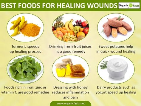 Best foods for healing wounds - infographic Foods For Ulcers, Ulcer Diet, Foods That Heal, Nutrition Consultant, Healing Foods, Fresh Fruit Juice, Iron Rich Foods, Power Foods, Healing Food