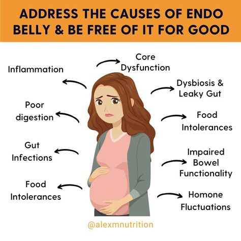 Do you have endo and feel bloated all the time? You’re not alone. 🙌⁠ ⁠ "Endo belly” is a symptom driven by various causes that can be treated and resolved, giving you your flat stomach back. 🌟⁠ ⁠ Some of these other drivers of endo belly include:⁠ ⁠ 🔥 Inflammation: Endometriosis triggers inflammation, causing abdominal swelling and bloating. ⁠ ⁠ 🍽️ Poor Digestion: Digestive issues in endometriosis lead to food not being fully digested, contributing to bloating.⁠ ⁠ 🐛 GI infections: Bacterial,... Endo Belly, Bloated All The Time, Poor Digestion, Food For Digestion, Digestive Issues, Superbowl Party Food, Leaky Gut, Superbowl Party, Flat Stomach