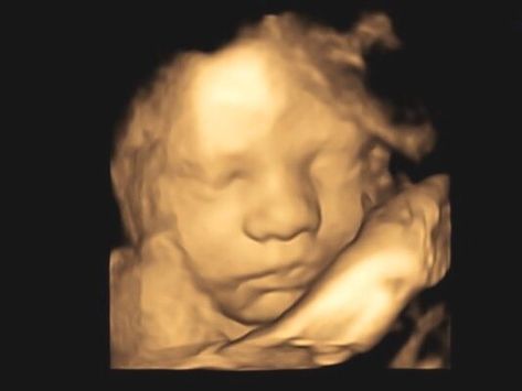 3d Ultrasound Pictures, 3d Ultrasound, 4d Ultrasound, Scheduling App, Baby Products Packaging, Custom Stuffed Animal, Baby Smile, Ultrasound Pictures, Baby Heartbeat