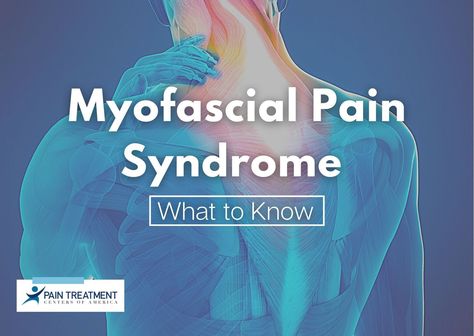 For people with myofascial pain syndrome, pain can become a regular part of their life. While it’s not certain exactly what causes it, one thing is for sure—people need relief. Myofascial Pain Syndrome, Referred Pain, Pain Relief Remedies, Dry Needling, Complex Regional Pain Syndrome, Shoulder Pain Relief, Musculoskeletal System, Myofascial Release, Best Stretches