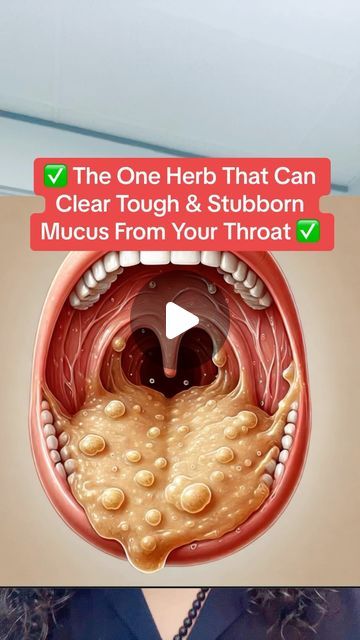 Raw (Mourab) Maraby on Instagram: "✅The One Herb That Can Clear Tough &
Stubborn Mucus From Your Throat✅ #mucus #drythroat #cough #phlegm" Throat Mucus Remedy, Herbs For Sinuses, Natural Remedy For Cough And Mucus, How To Get Mucus Out Of Throat, Stubborn Cough Remedies, Mucus Relief Remedies How To Get Rid, Chest Infection Remedies, Mucus Relief Remedies, Clear Mucus From Throat