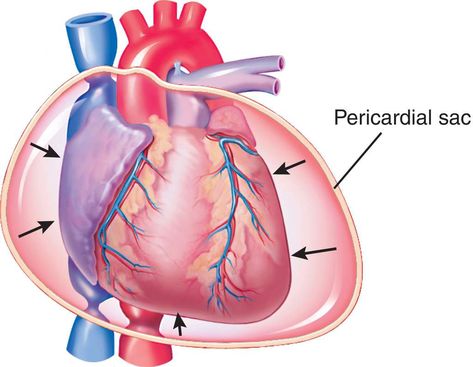 Cardiac Tamponade, Future Career, Cardiology, Cheat Sheet, Cheat Sheets, Medicine, Career, Book Cover, Quick Saves