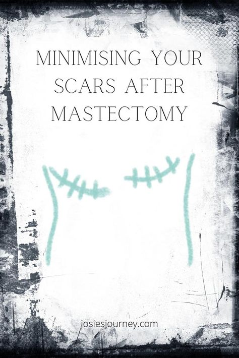 Here is what worked for me and some tips to help with minimising your scars after mastectomy too. Mastectomy Humor Funny, Mastectomy Scar Tattoo Flat, After Mascetomy, Flat Closure Mastectomy Tattoo, Going Flat After Mastectomy Fashion, Post Mastectomy Exercises, Flat Closure Mastectomy, Aesthetic Flat Closure Mastectomy, Mastopexy Recovery