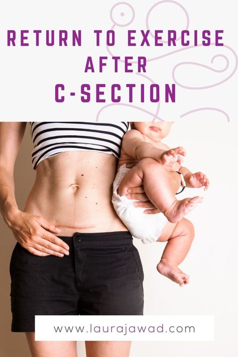 Post C Section Workouts, Postpartum C Section Workout, Post Csection Workouts, Post Partum Workout For C Section, Exercises For After C Section, Post C Section Workout Plan, C Section Recovery Workout, C Section Exercise Workouts, Workouts Post C Section