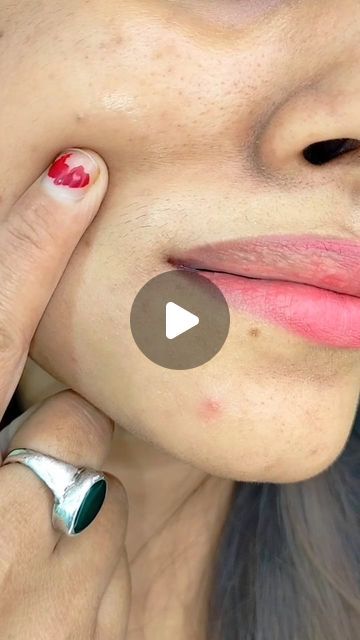 Upper Lip Hair Removal At Home, Face Hair Removal Home Remedies, Face Clean Up At Home, Face Wrinkles Remedies, Upper Lip Hair Removal, Upper Lips, Beauty Diy Skincare, Hair Removal At Home, Face Diy