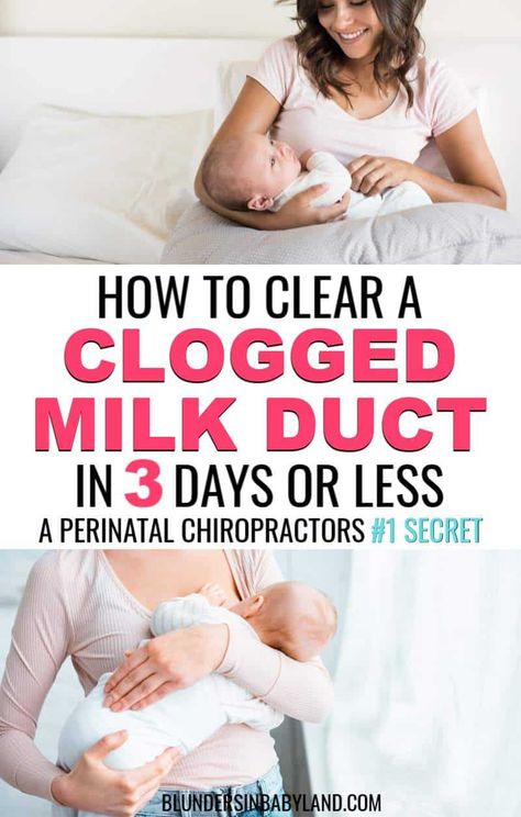 Clogged milk duct? DON'T let it turn into mastitis. Check out these helpful tips on how to clear a clogged milk duct FAST. Plus learn this perinatal chiropractor's number one method! #breastfeedingtipsforbegginers #breastfeedingproblems #cloggedmilkduct How to Clear a Clogged Milk Duct in 3 Days or Less - Clogged Milk Duct Remedies Mastitis Remedies, Clogged Milk Duct, Blocked Milk Duct, Baby Bottle Storage, Nursing Positions, Clogged Duct, Pumping Tips, Breastfeeding Baby, Breastfeeding Mom