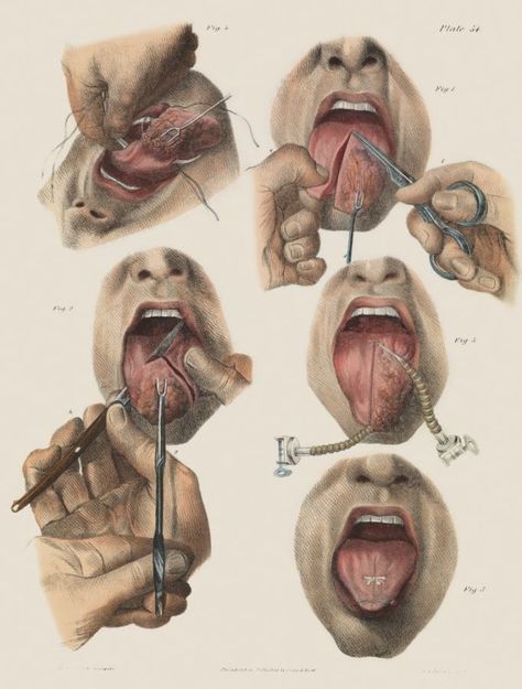 5 Terrifying Pictures, Medical Drawings, Vintage Medical, Medical Art, Medical Illustration, Medical History, Anatomy Art, Human Anatomy, Graphic Image