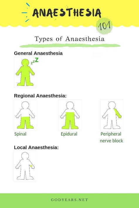 How many types of Anaesthesia do you know of? Types Of Anesthesia, Anesthesiologist Notes, Anesthesia School, Eye Makeup 90s, Medical Terminology Study, Nurse Anesthesia, Perioperative Nursing, Makeup 90s, Makeup Everyday