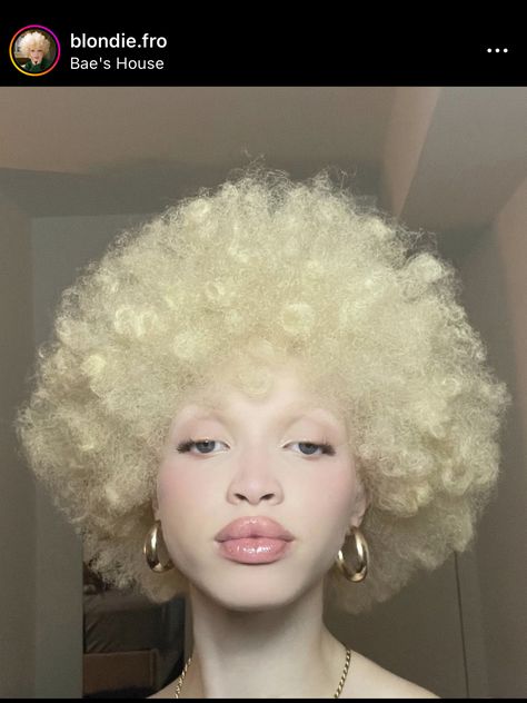 Albino Model, Albino Girl, Why Her, Black Femininity, Black Person, Aesthetic People, 4c Hairstyles, Hair Reference, Black Girls Hairstyles