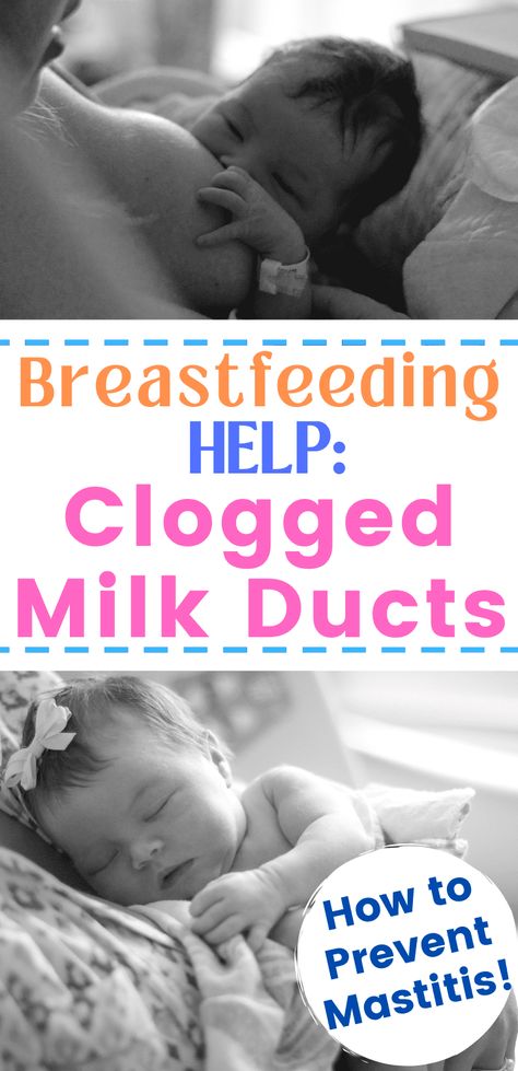 Experiencing clogged milk ducts? Here is how to tell, how to unclog a milk duct while breastfeeding, and how to prevent mastitis! Home remedies for clogged milk duct Mastitis Remedies, Clogged Milk Duct, Preventing Mastitis, Clogged Duct, Nursing Mother, Baby Prep, Baby Eating, Third Baby, Postpartum Care