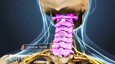 There are many ways for neck and shoulder pain to occur together. Here are some potential causes of neck pain and shoulder pain that your doctor might diagnose. Stenosis Exercises, Severe Neck Pain, Nerve Anatomy, Cervical Disc, Cervical Pain, Chronic Back Pain, Cervical Spondylosis, Lower Back Pain Exercises, Icd 10