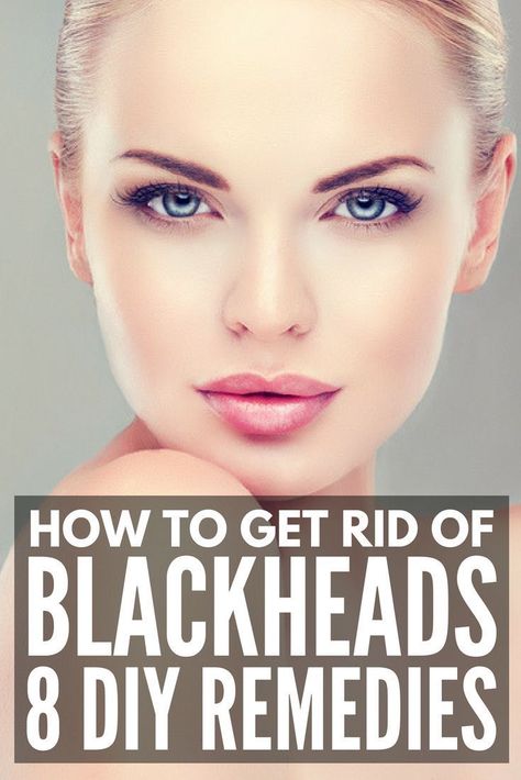 How to Get Rid of Blackheads | Looking for the best way to remove blackheads naturally? We’re sharing 8 DIY ideas to help banish blackheads on your nose, cheeks, forehead, and chin fast (sometimes overnight!). Forget expensive store products and try these natural remedies using things like baking soda, honey, and sea salt for instant results and clear skin you’ll love! #blackheads #acne #acneremedies #skinproblems #skincare #skincareroutine Forehead Blackheads, Clear Skin Diet, Forehead Acne, To Remove Blackheads, Blackhead Mask, Makeup 2018, Acne Overnight, Clear Skin Face, Prom Makeup Looks