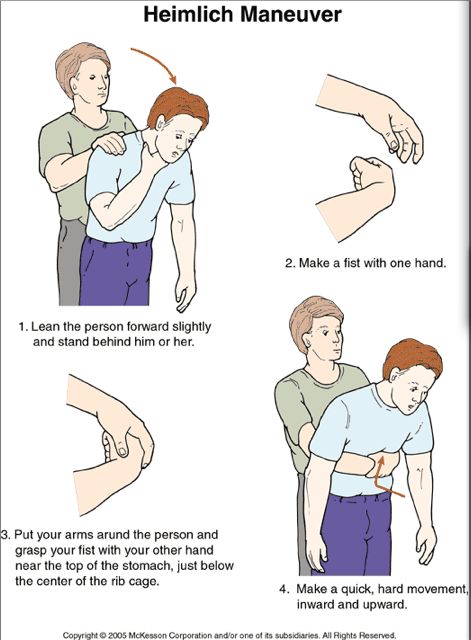 Heimlich maneuver - for adults, children, infants, pregnant women, yourself & your pets | GODYEARS Heimlich Maneuver, Medical Life, First Aid Cpr, First Aid Tips, Emergency First Aid, Survival Life Hacks, Survival Life, Disaster Preparedness, Girls Camp