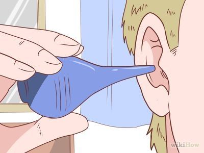 How to Deep Clean Your Ears -- via wikiHow.com Clean Ear Wax Out, Saline Rinse, Impacted Ear Wax, Earwax Candle, Ear Cleaning Wax, Vertigo Exercises, Ear Wax Buildup, Ear Candling, Outer Ear