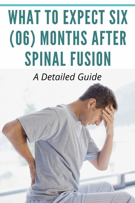 Stenosis Of The Spine, Spinal Degeneration, Sciatic Nerve Stretches, Spinal Fusion Surgery, Spinal Fusion, Spinal Decompression, Spinal Surgery, Basic Anatomy And Physiology, Spinal Nerve