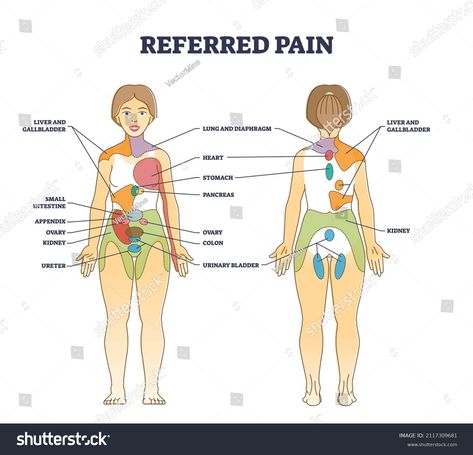 Educational Chart, Referred Pain, Medical Anatomy, Body Pain, Editing Software, Logo Templates, Disease, Social Media, Map