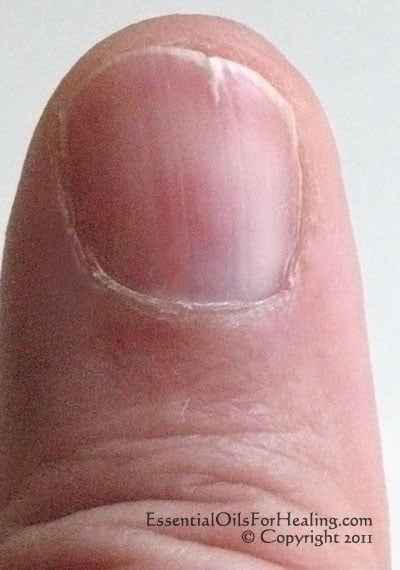 Strong Nails Diy, Essential Oils For Healing, Oils For Healing, Nail Remedies, Split Nails, Cracked Nails, Nails Healthy, Essential Oils Guide, Nail Care Tips