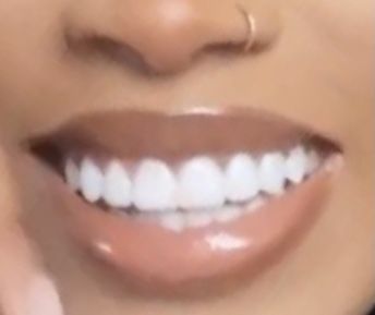 Natural White Teeth, Clear Teeth, White Teeth Black Women, Perfect White Teeth, Different Teeth Shapes, Teeth Claim, Pretty Teeth Aesthetic, Teeth Black Women, Straight Teeth Aesthetic