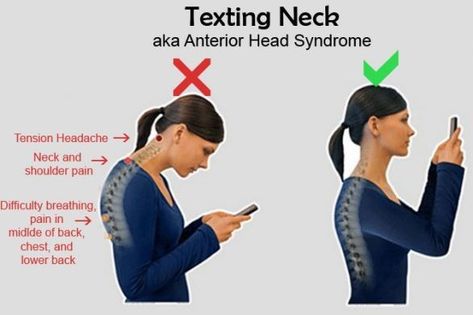 The Ultimate Exercises to Improve Posture (Simple and Effective) Forward Head Posture Exercises, Shoulder Posture, Text Neck, Neck And Shoulder Muscles, Forward Head Posture, Neck Problems, Posture Exercises, Neck And Shoulder Pain, Tension Headache