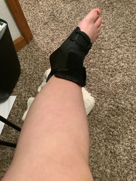 Ankle Cast, It Cast