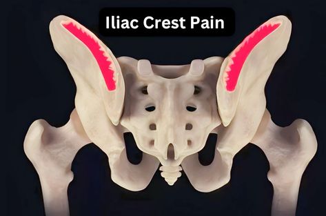 Relieve Iliac Crest Pain: Up To Date Treatments
 



Various factors, such as overuse or injury, can cause pain over the iliac crest. Consulting a healthcare professional Iliac Crest, Enjoying Life, Pain Free, Say Goodbye, Healthcare Professionals, Up To Date, Get Back, Enjoy Life, Back Pain