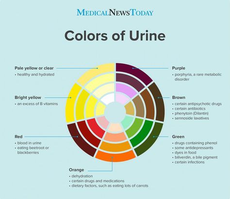 What causes dark urine? Green Urine, Pee Color, Color Of Urine, Urine Color, Birth Colors, Shingle Colors, Metabolic Disorders, Color Meanings, Nursing Notes