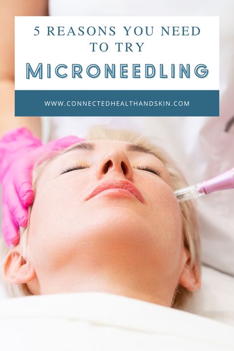 Micro Needling Benefits, Microneedling Aesthetic, Microneedling Benefits, Benefits Of Microneedling, After Microneedling, Esthetician Room, Girl Aesthetics, Cosmetic Treatments, Loose Skin