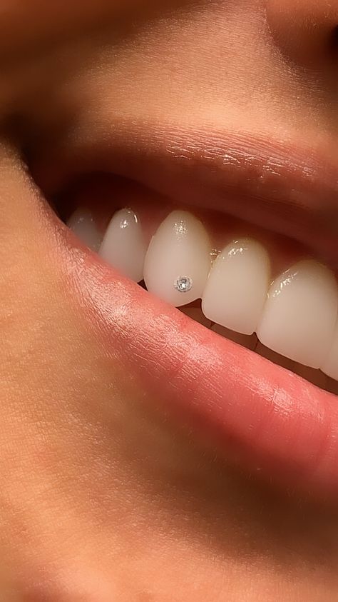 Tooth Diamond, Teeth Gems, Pretty Teeth, Grillz Teeth, Gum Inflammation, Diamond Teeth, Veneers Teeth, Loose Tooth, Tooth Gems