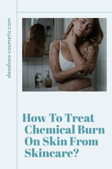 How To Treat Chemical Burns from Skincare: A Comprehensive Guide Did you know you could get a chemical burn from your skincare products? No need to panic! Our comprehensive guide covers everything from symptoms to treatments. Pin this for a step-by-step guide on what to do in case of a skincare mishap. Chemical Burn, Treat Burns, Skin Burns, Beauty Natural Products, Skin Remedies, A Nightmare, Facial Wash, Fitness Beauty, Face Skin