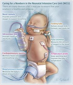 This Patient Page describes why your baby may need to spend time in the neonatal intensive care unit, what will happen there, and what to expect when your baby goes home. Nicu Nurse Education, Neonatal Nurse Practitioner, Neonatal Care, Love And Understanding, Pediatric Physical Therapy, Nursing Student Tips, Neonatal Nurse, Nursing School Survival, Neonatal Intensive Care Unit