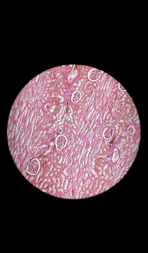 Kidney under microscope in histology Under Microscope