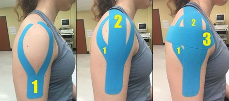 Rotator Cuff Injury Exercises, Rotator Cuff Rehab, Shoulder Rehab Exercises, Rotator Cuff Exercises, Rotator Cuff Surgery, K Tape, Shoulder Rehab, Rotator Cuff Tear, Kinesio Tape