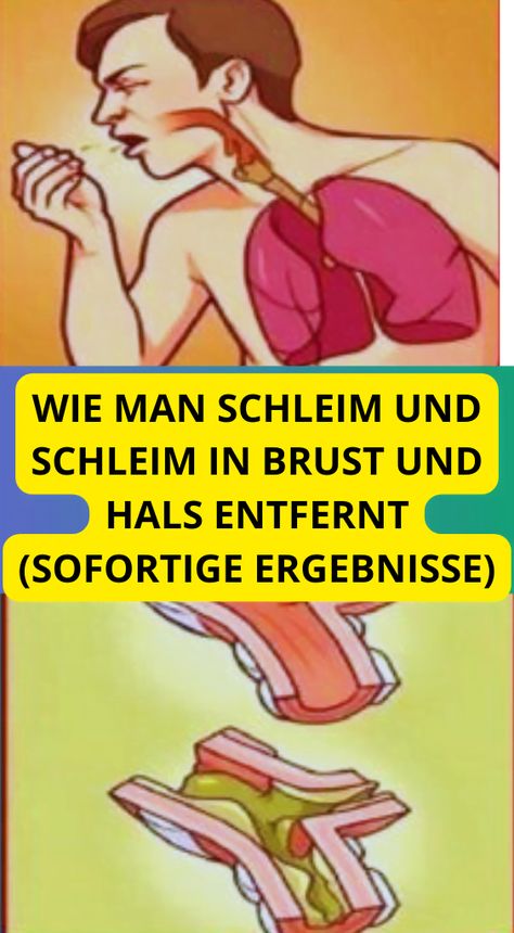 WIE MAN SCHLEIM UND SCHLEIM IN BRUST UND HALS ENTFERNT (SOFORTIGE ERGEBNISSE) Getting Rid Of Phlegm, Natural Face Care, Heath Care, Handmade Watch Strap, Slim Diet, Weight Los, Perfect Skin Care Routine, Bath And Body Care, Health Facts