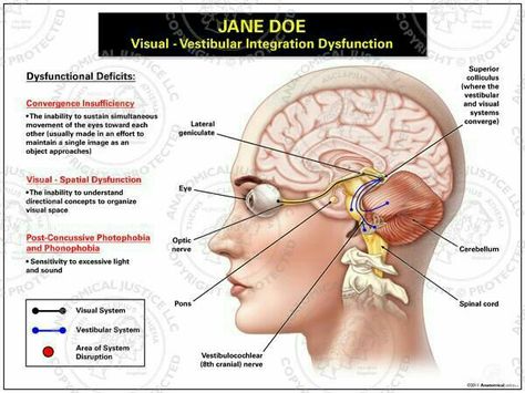 Vestibular Exercises, Vestibular Disorder, Convergence Insufficiency, Post Concussion Syndrome, Medical Illustrations, Sensory Disorder, Vestibular System, Visual Processing, Medical Animation