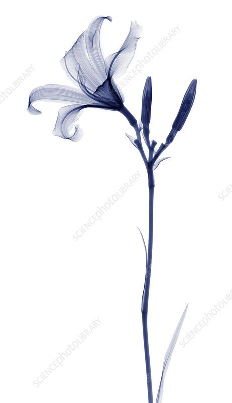 Ray Tattoo, X-ray Images, Lily Tattoo, Science Photos, Lily Flower, Photo Library, X Ray, Flower Tattoo, Flower Art