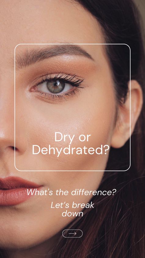 Discover the basics: Dry skin lacks oils, while dehydrated skin thirsts for water. But here's the common ground - both need your love and care. Hydrate, moisturize, and let your skin glow with health! 💧✨ Which one does your skin need more of today? #SkinCare #Skin #DryVsDehydrated #LoveYourSkin #DrySkin #DehydratedSkin Summer Skincare Products, Summer Skincare, Life Tips, Beauty And Lifestyle, Dehydrated Skin, My Skin, Skincare Products, Self Care, Self Love