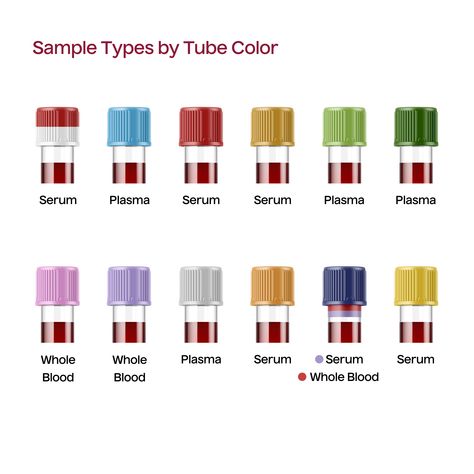 Here’s a quick sample type reference for all phlebotomists—seasoned or new. Save it for when you need a little reminder! 🧪✨  #phlebotomy #tubecolors #sampletypes #phlebotomytraining #labtech #phlebotomist Phlebotomy Study Guide, Phlebotomy Tips, Phlebotomy Order Of Draw Projects, Phlebotomy Study Notes, Phlebotomist Aesthetic, Order Of Draw Phlebotomy, Phlebotomy Tubes, Order Of Draw Phlebotomy Poster, Order Of Blood Draw Phlebotomy