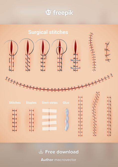 Surgical suture stitches realistic set o... | Free Vector #Freepik #freevector #abstract #medical #science #medicine How To Do Stitches Medical, Stitches Drawing Medical, Medical Stitches, Stitches Medical, Surgical Stitches, Suture Techniques, Tattoos Spine, Back Tattoos Spine, Danganronpa Oc