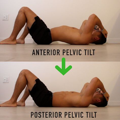 How I Fixed my Anterior Pelvic Tilt (APT) - Ronald Leite - Medium Fix Anterior Pelvic Tilt, Anterior Pelvic Tilt, Posture Correction Exercises, Beginner Exercises, Stability Exercises, Sciatica Exercises, Pelvic Tilt, Lower Back Pain Exercises, Posture Exercises