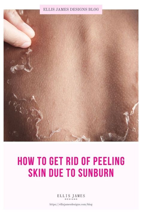 If you are struggling with your skin peeling, make sure to look at the reasons and recommendations in this post. | How to Stop Peeling Skin: Ways to Stop Peeling Once It Starts | Peeling Skin: Natural Ways to Get Rid of Peeling Skin Fast | How to get rid of peeling skin immediately | Why Does My Skin Peel? How to Get Rid of Skin Peeling | How to Exfoliate Peeling Skin | Should you exfoliate peeling skin? | #founditonamazon #skinpeeling #skincaretips #beautytips #skintips Skin Peeling From Sunburn, Dry Peeling Skin, Get Rid Of Sunburn, Skin Peeling On Face, Sunburn Peeling, Natural Remedies For Sunburn, Sunburn Remedies, Skin Peel, Pimples Under The Skin