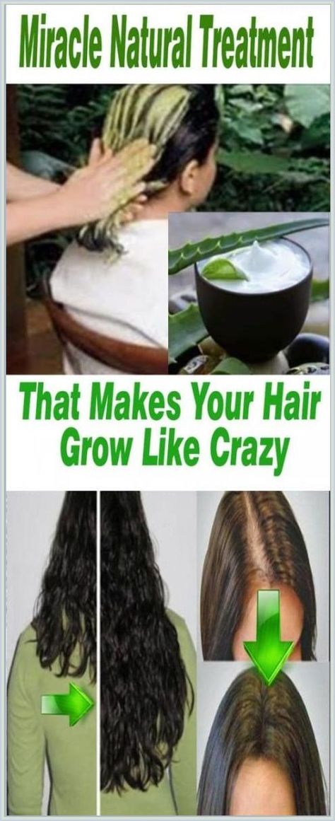 YOUR HAIR WILL GROW LIKE CRAZY- GROW HAIR Long, Thick, Healthy FAST! Grow Hair Long, Healthy Office, What Is Health, Ways To Be Healthier, How To Grow Your Hair Faster, Womens Health Care, Hair Growing Tips, Health Plus, Hair Remedies For Growth