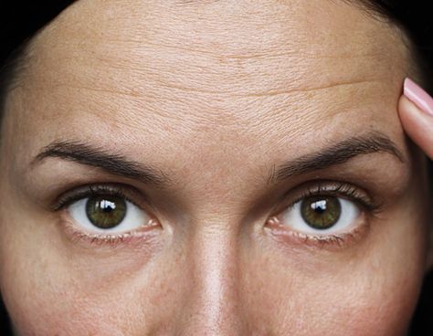 The Best Anti-Aging Ingredients for Diminishing Forehead Wrinkles Frown Lines, Smile Lines, Forehead Wrinkles, Acne Solutions, Facial Exercises, Anti Aging Ingredients, Wrinkled Skin, Glowing Complexion, Best Anti Aging