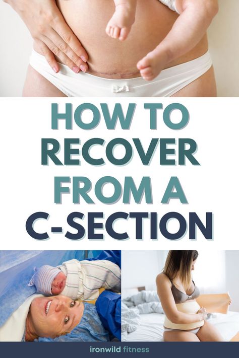 Wondering how you can help your body with c-section recovery? Find useful cesarean recovery tips and exercises in this post. (From a 2-time c-section mom!) Exercises Post C Section, C Section Recovery Tips, Postpartum C Section Recovery, Cesarean Recovery, Postpartum Wellness, Post C Section, C Section Recovery, Postpartum Health, Deep Breathing Exercises